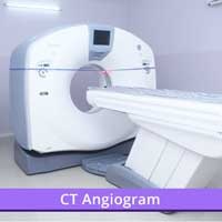 CT Angiogram center in erode