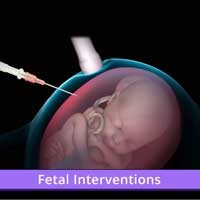 Fetal Interventions center in erode